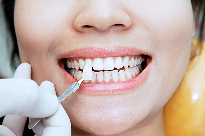 Реставрация зубов опытными специалистами
